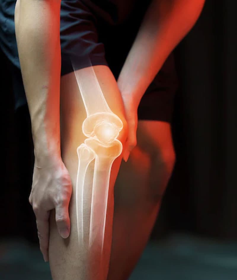 Knee Arthritis & Joint Preservation